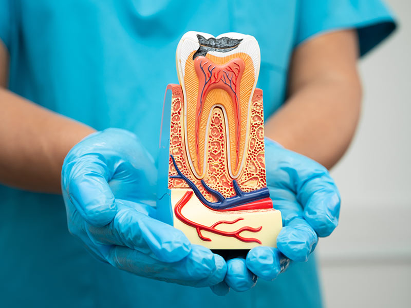 endodontia