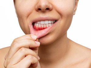 periodontia
